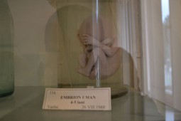 Muzeul Paul Taralunga -embrioni(2)